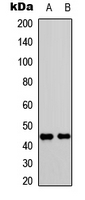 Anti Phospho CD182 S347 Rabbit Polyclonal Antibody U0624 产品列表 善本生物科技